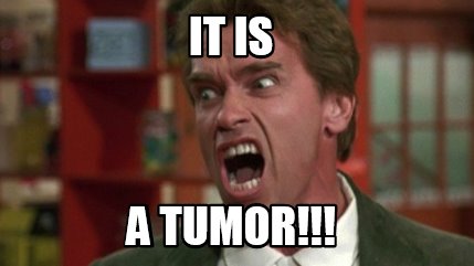 it-is-a-tumor